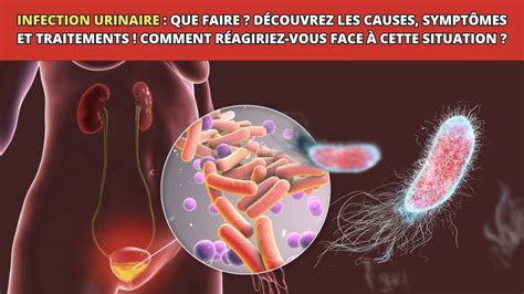 Infection urinaire: causes, symptômes, traitement et。